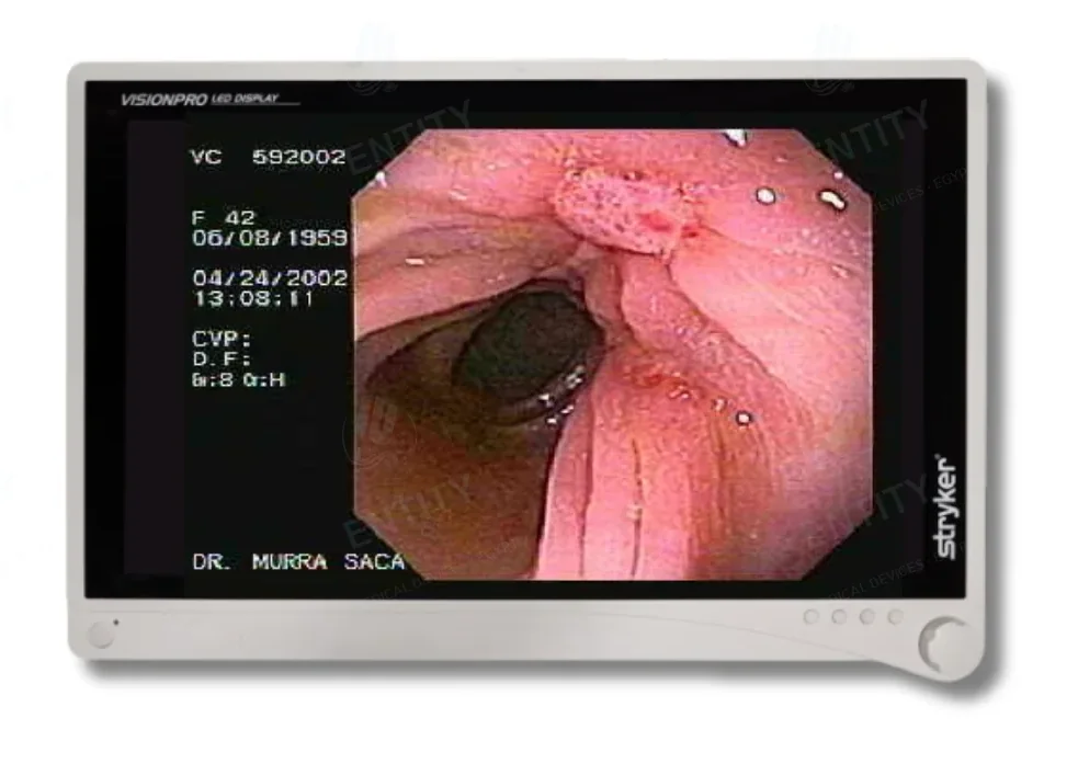 Stryker Monitor Vision Pro
