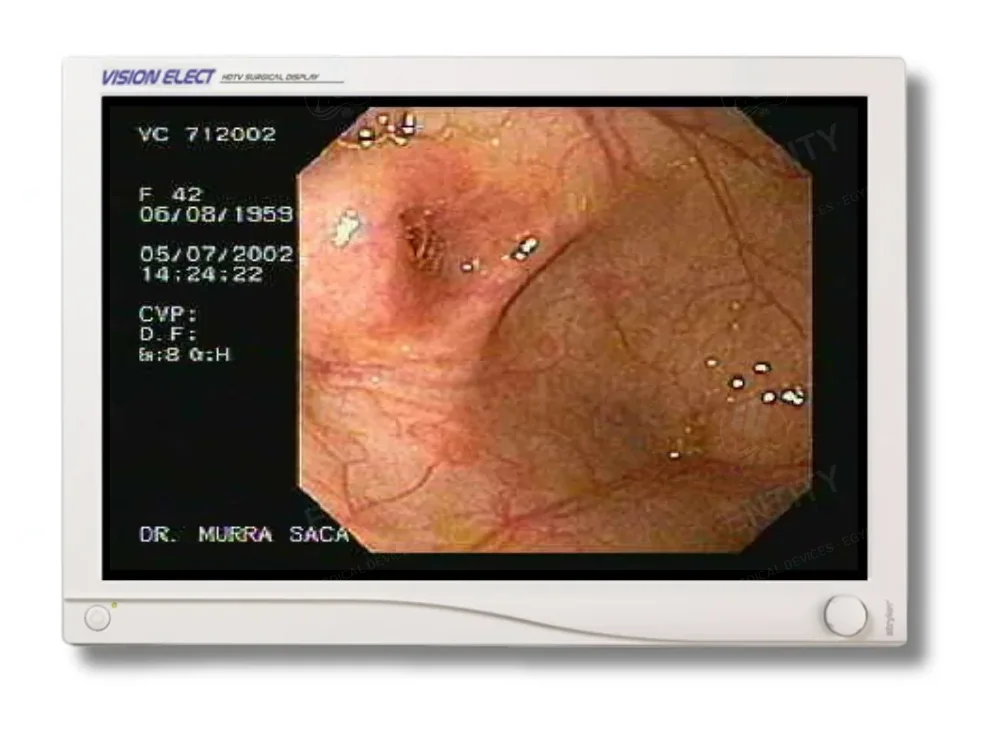 Monitor Stryker Vision