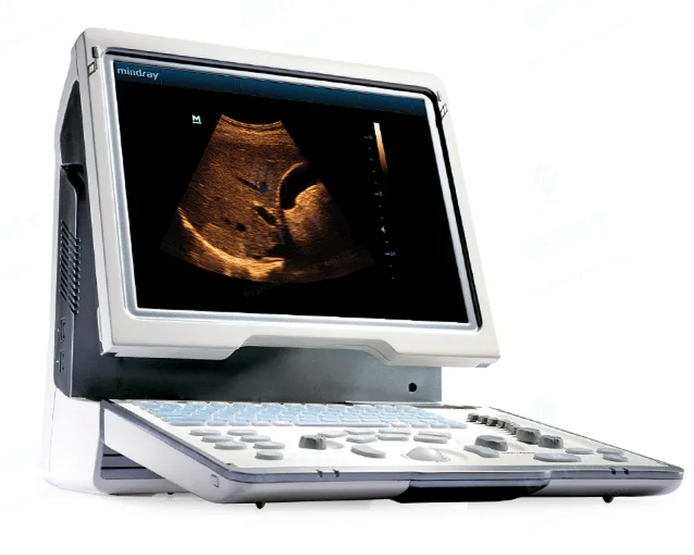 جهاز سونار وموجات فوق صوتية محمول Mindray DP-50 / MX7