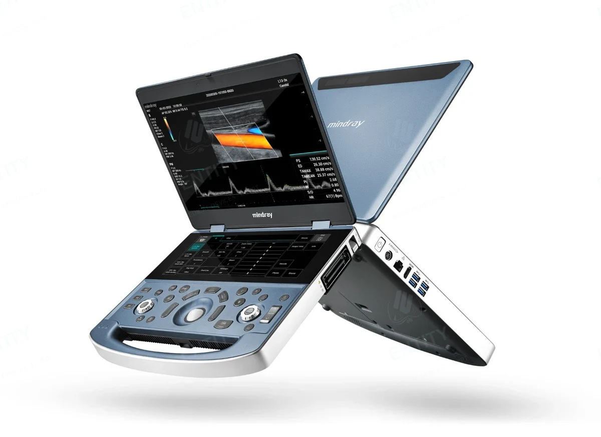 جهاز سونار وموجات فوق صوتية محمول Mindray DP-50 / MX7 - 2