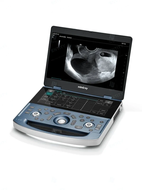 جهاز سونار وموجات فوق صوتية محمول Mindray DP-50 / MX7 - 3
